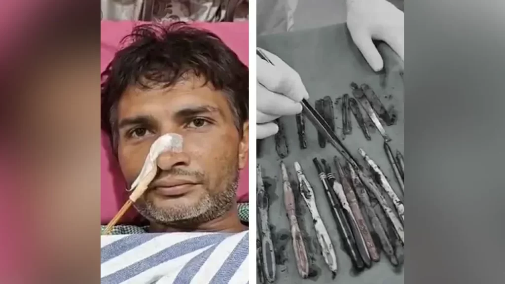 চামচ ও ব্রাশ খাওয়ার ভয়ংকর নেশায় আসক্ত যুবক!